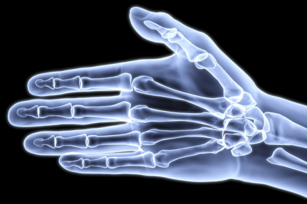 White and gray 3-D xray illustration showing the bones of the hand against a black background